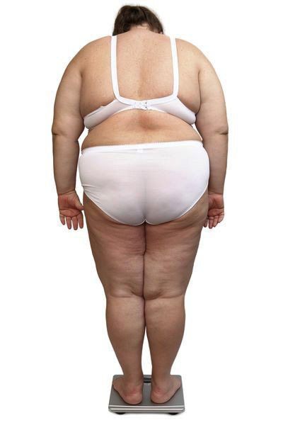 L'obésité rend la vie quotidienne beaucoup plus difficile : elle entraîne souvent une dépression profonde.